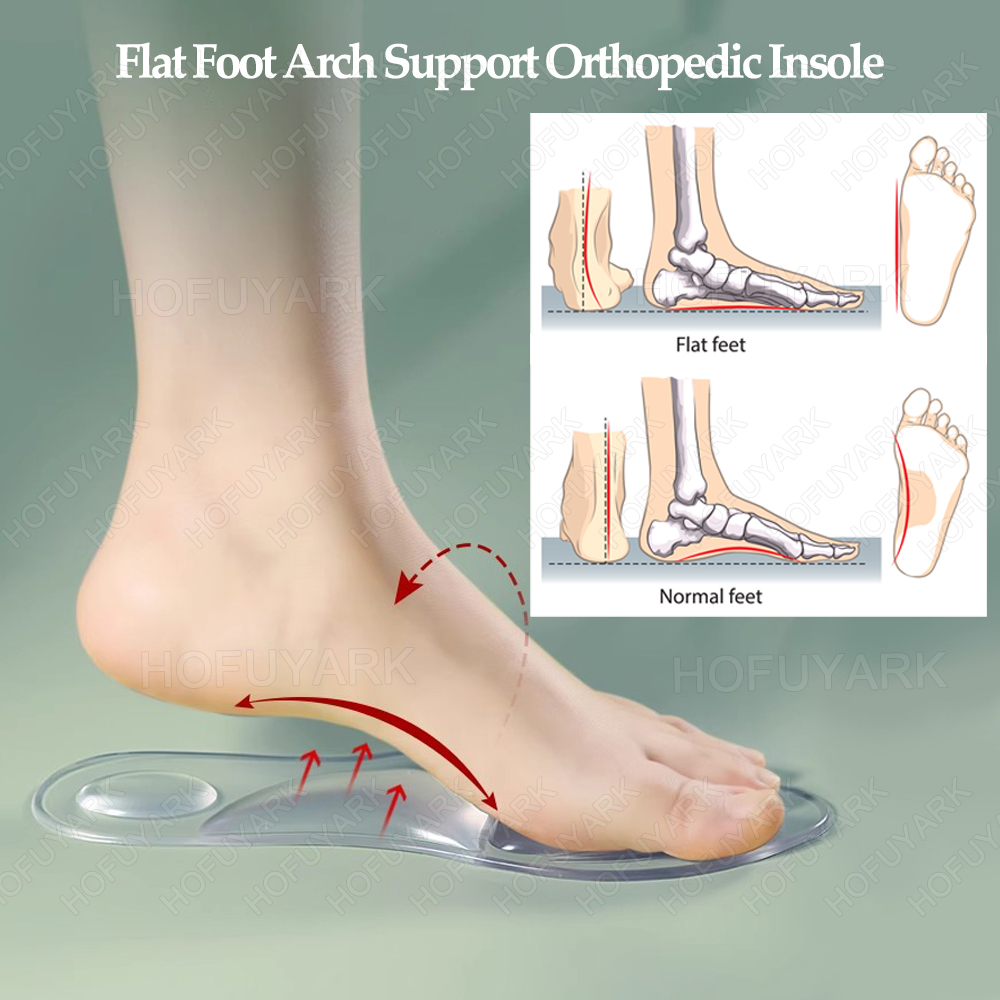 ซิลิโคนเจล Insoles ศัลยกรรมกระ - Women'S Shoes For Plantar Fasciitis บทวิจารณ์และราคา